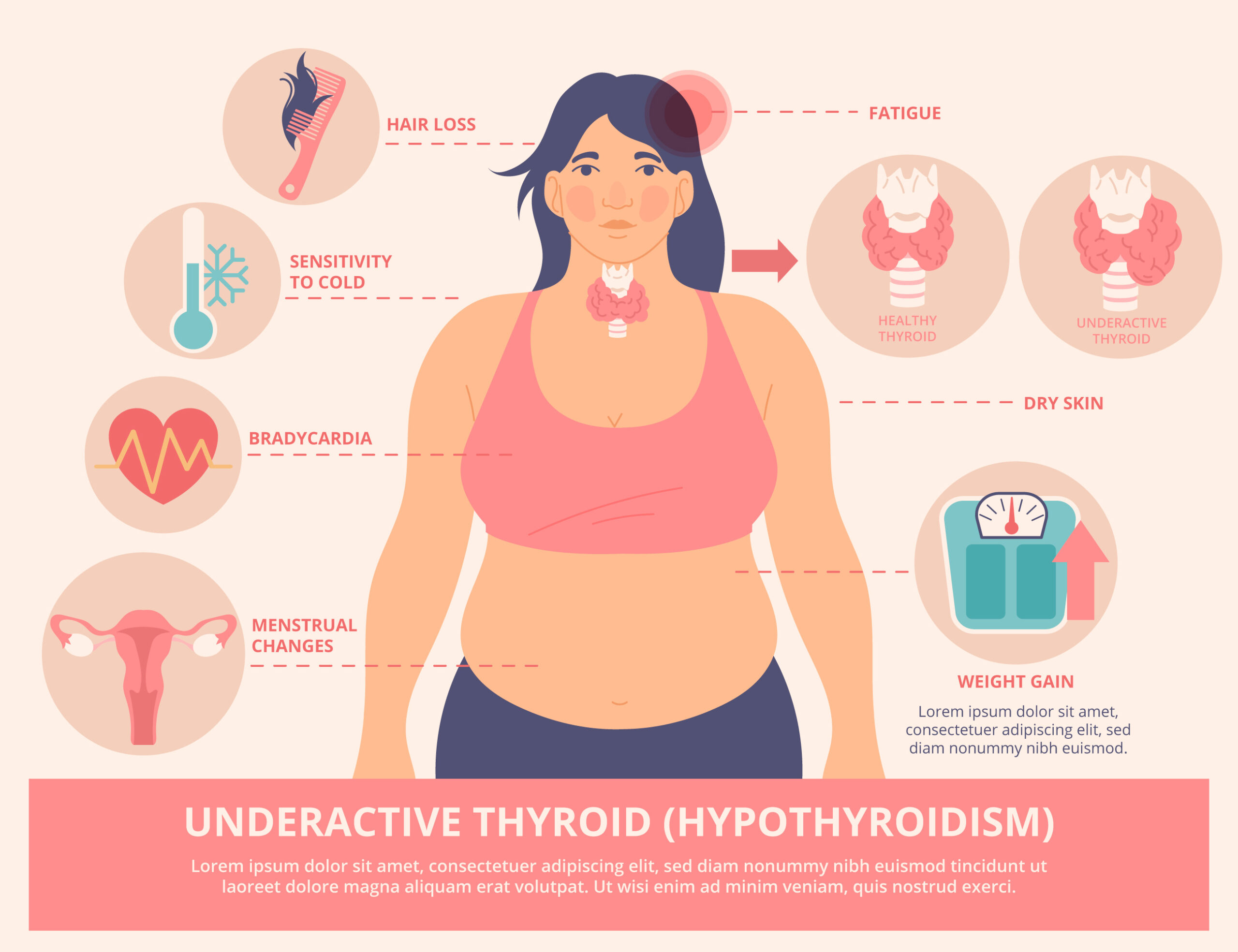 Thyroid: Hormones, Diseases, and Treatment
