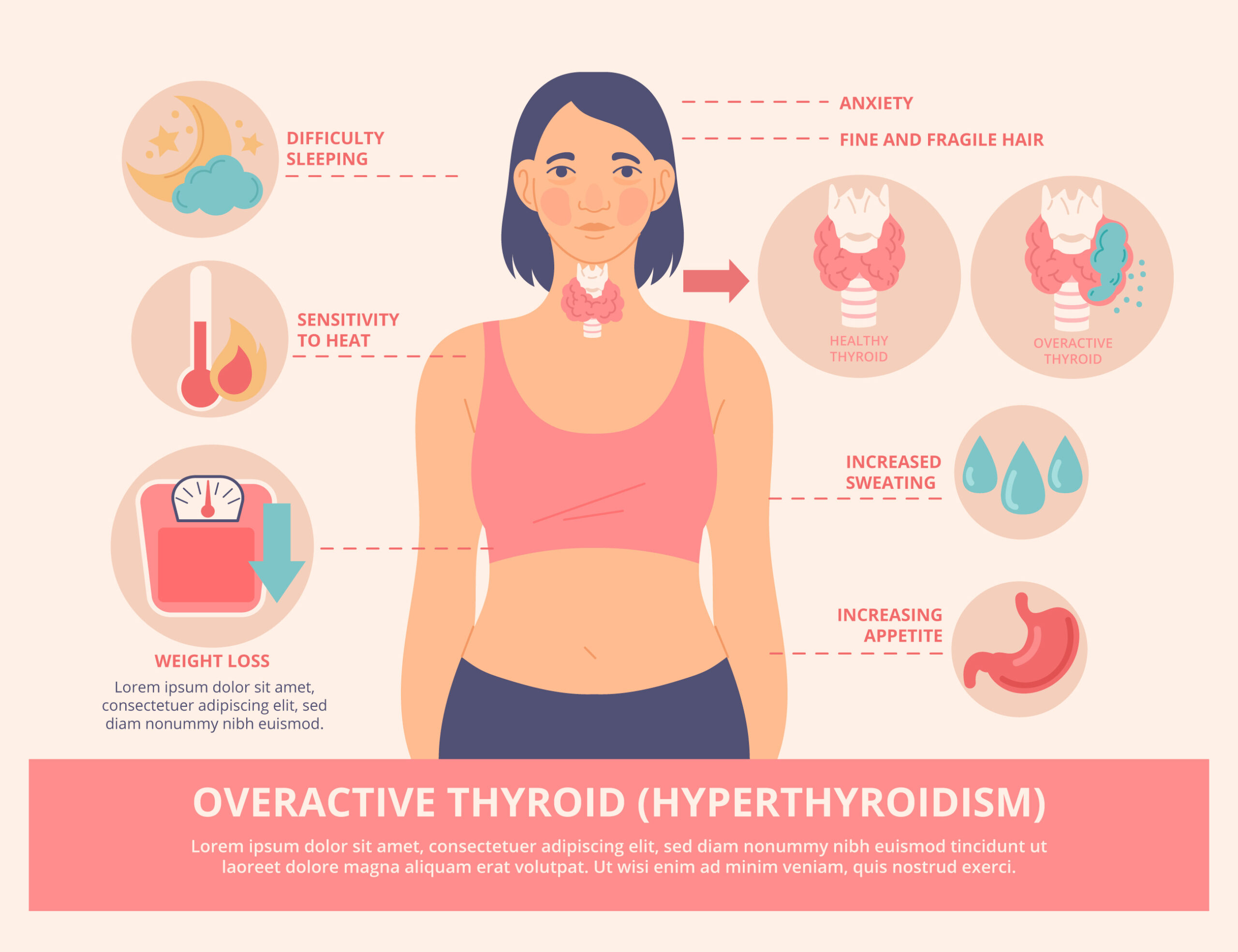 Thyroid: Hormones, Diseases, and Treatment