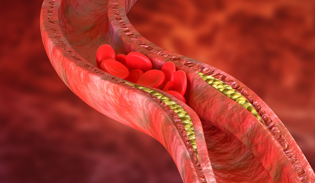 What is Cholesterol? How to Lower Cholesterol? Normal Levels, Functions, and Types