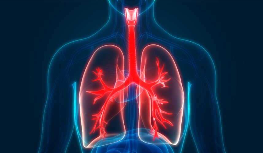 Cystic Fibrosis: What Is, What Are Clinical Symptoms?