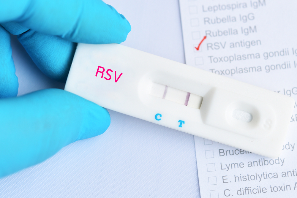 RSV (Respiratory Syncytial Virus): What Is, Symptoms