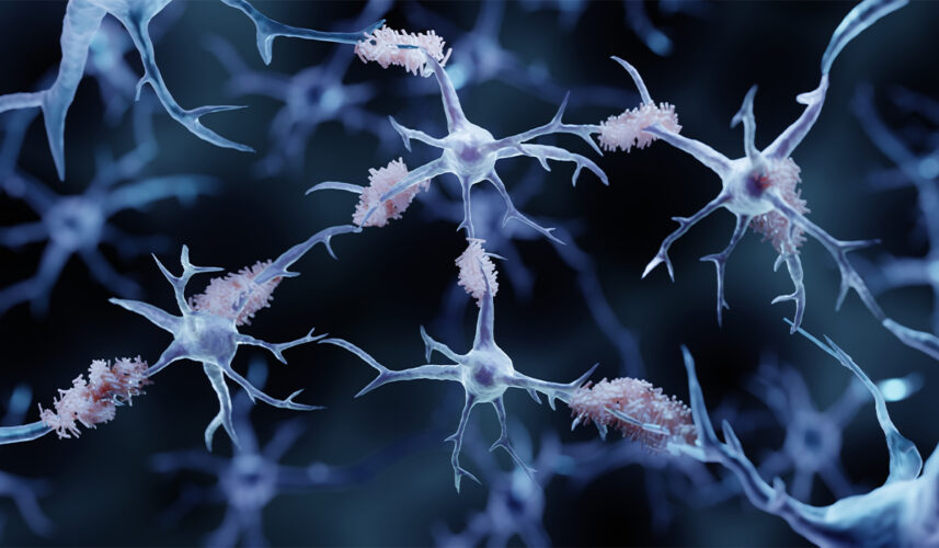 Amyloidosis: What Is, Types, Causes, Tests, and Treatments