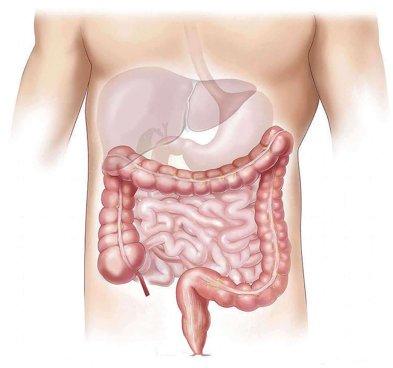 Crohn's Disease: Causes, Symptoms, Diagnosis, and Treatment