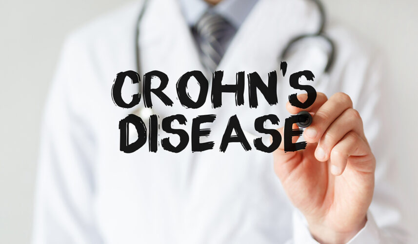 Crohn's Disease: Causes, Symptoms, Diagnosis, and Treatment