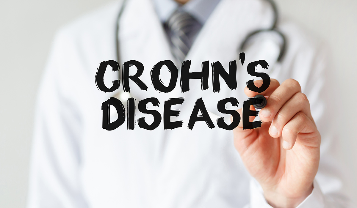 Crohn's Disease: What is, Causes, Symptoms, Diagnosis, and Treatment