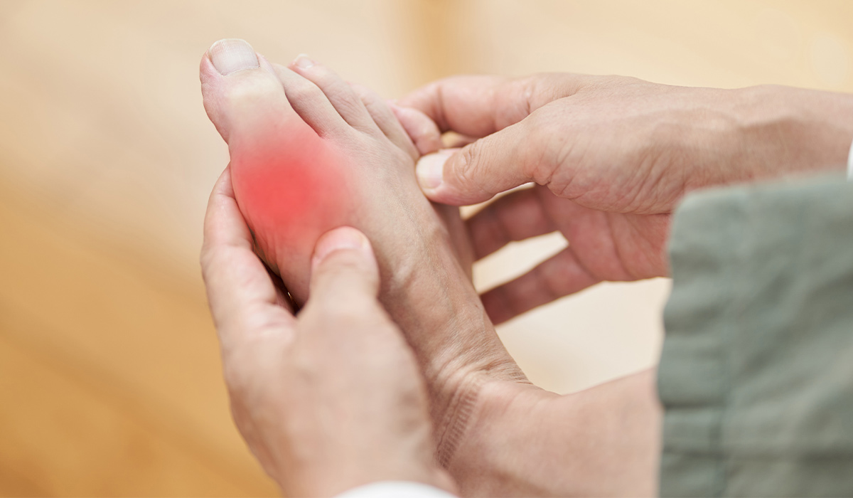 Gout: What Is, Symptoms, Treatment, and Causes