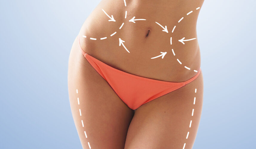 Cellulitis: What Is, Symptoms, Causes, and Risk Factors