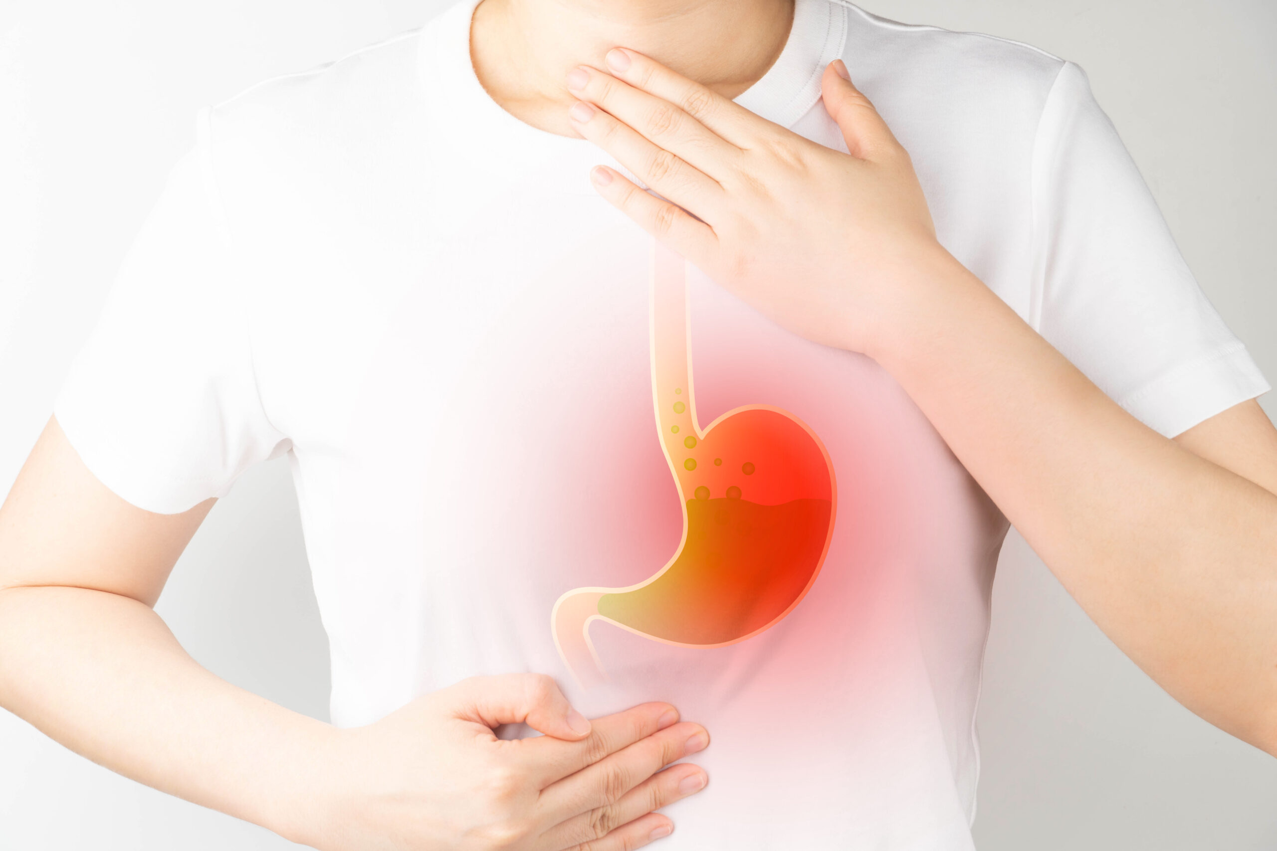 GERD: What Is, Symptoms, Causes, and Treatments