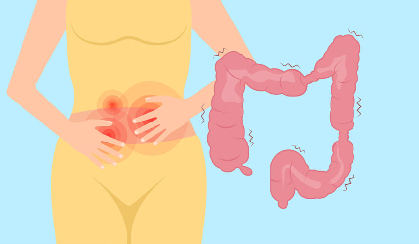 Irritable Bowel Syndrome (IBS): What It Is, Symptoms, Causes, and Treatment