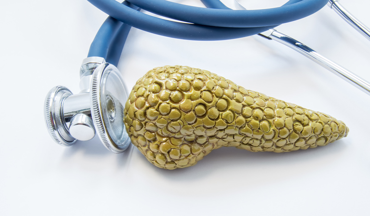Pancreatic Cancer: What Is, Symptoms, Causes, and Diagnosis