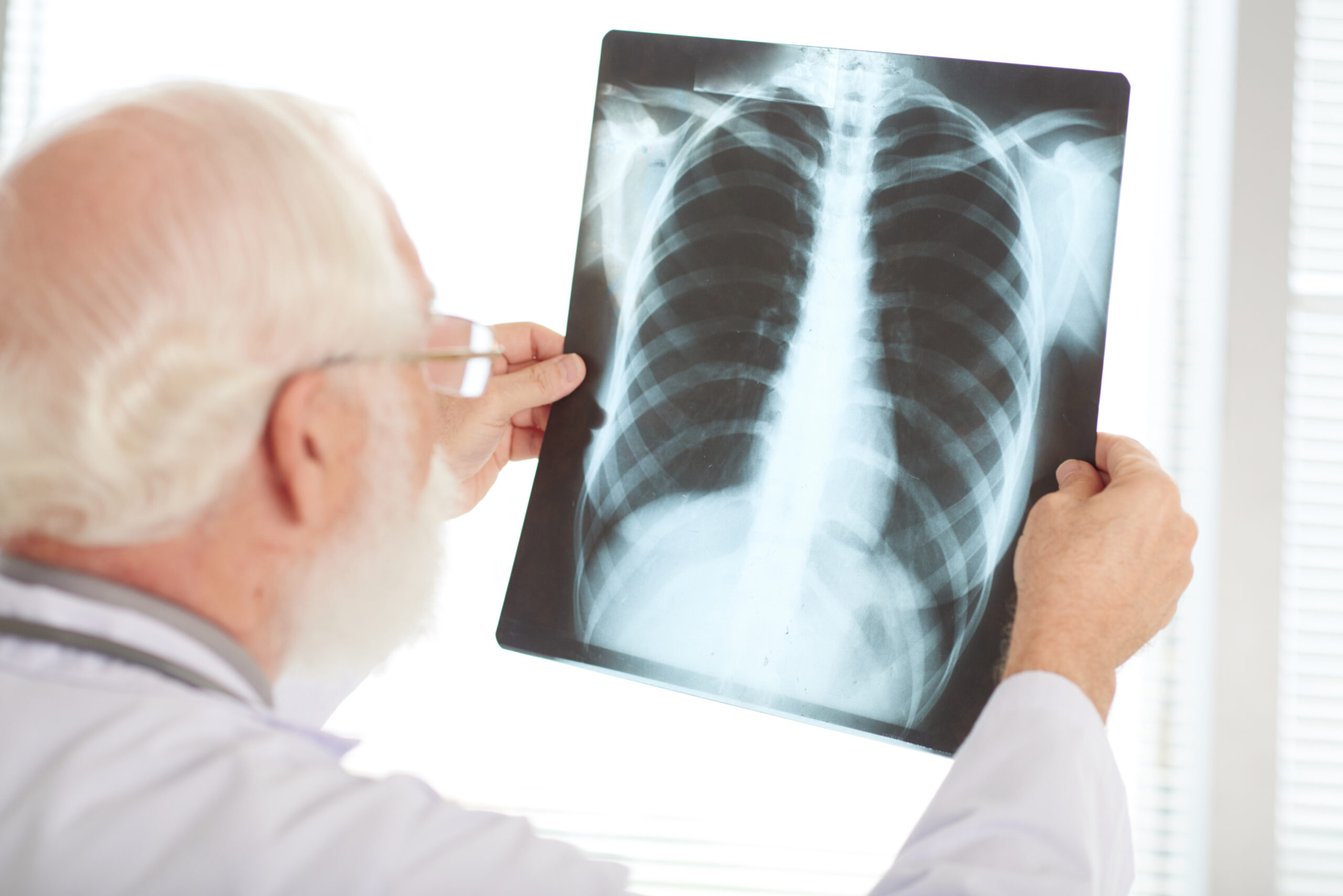 Pneumonia: What Is, Dangers, Types, and Treatment