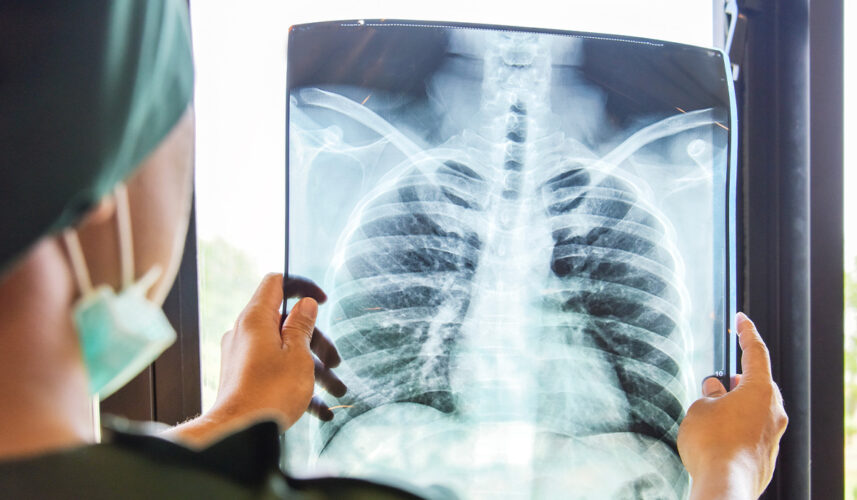 Pneumonia: What Is, Dangers, Types, and Treatment
