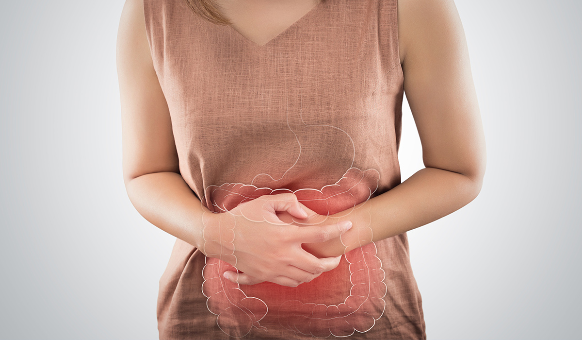 Ulcerative Colitis: Symptoms, Causes, and Diet
