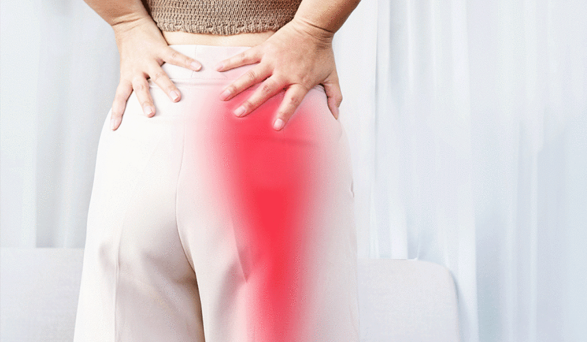 Sciatica: What Is, Causes, Symptoms, Diagnostic, and Treatment