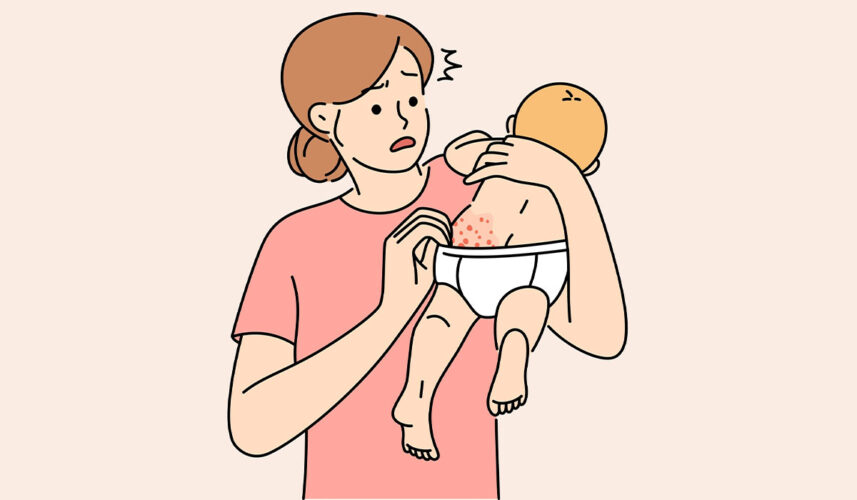 Roseola: What Is, Causes, Symptoms, Diagnosis, and Treatment