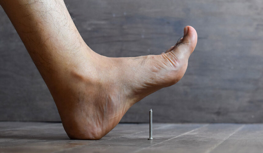 Tetanus: What Is, Causes, Risk Factors, Signs, and Treatment