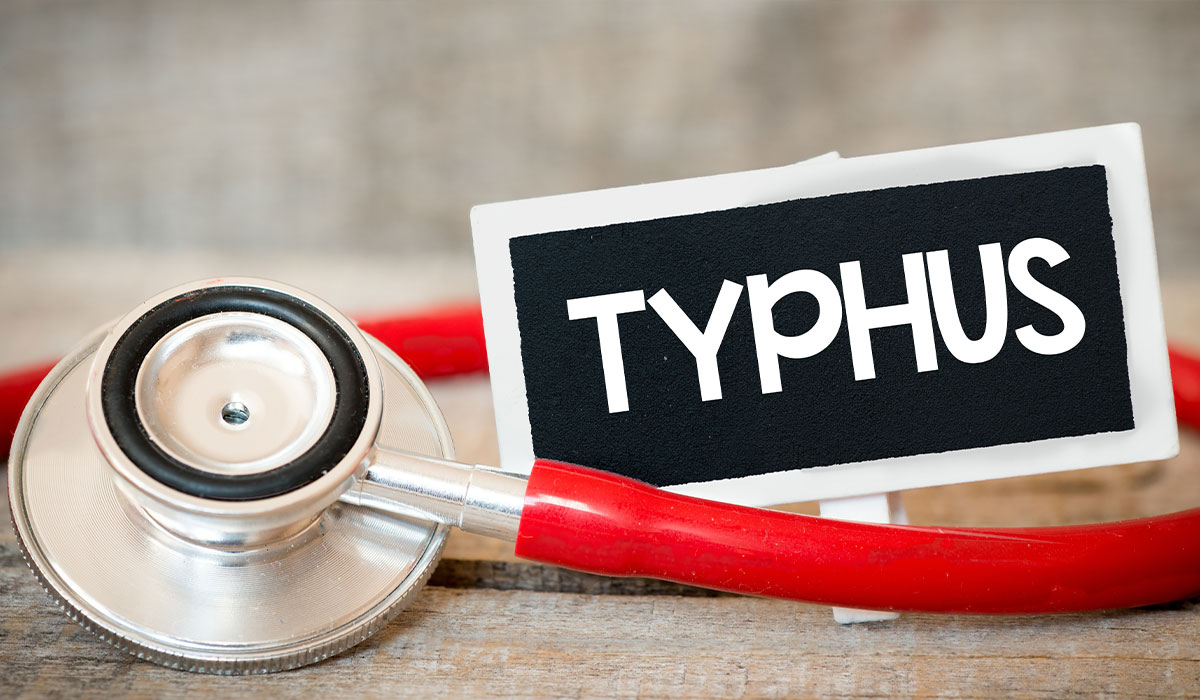 Typhus: What Is, Types, Causes, Symptoms, and Treatment