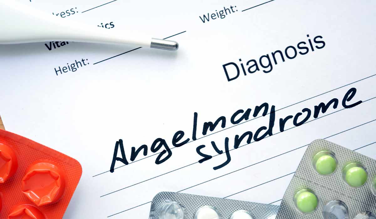 Angelman Syndrome: What Is, Causes, Symptoms, and Early Signs