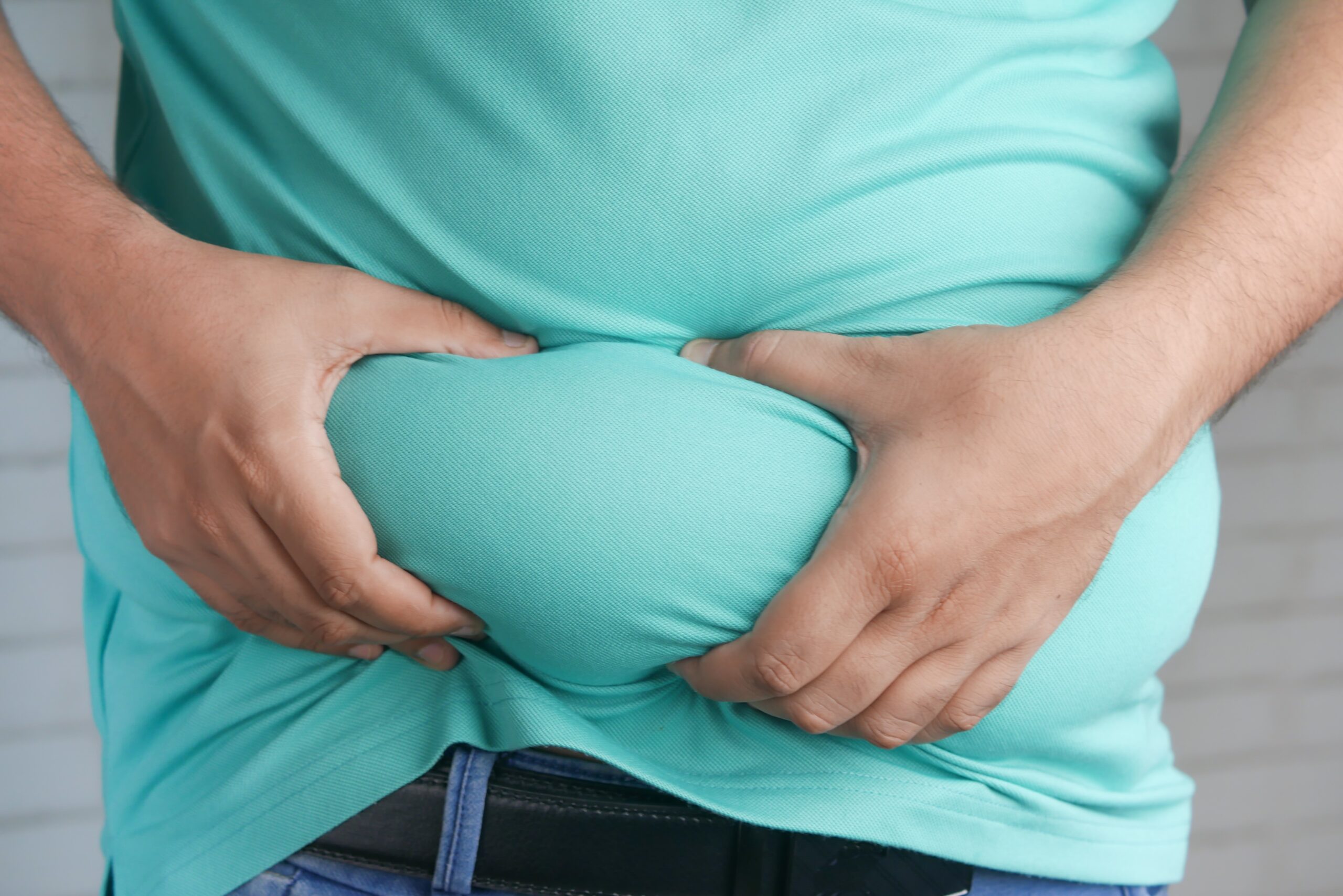 Ascites: What Is, Causes, Risk Factors, Treatment, and Prevention