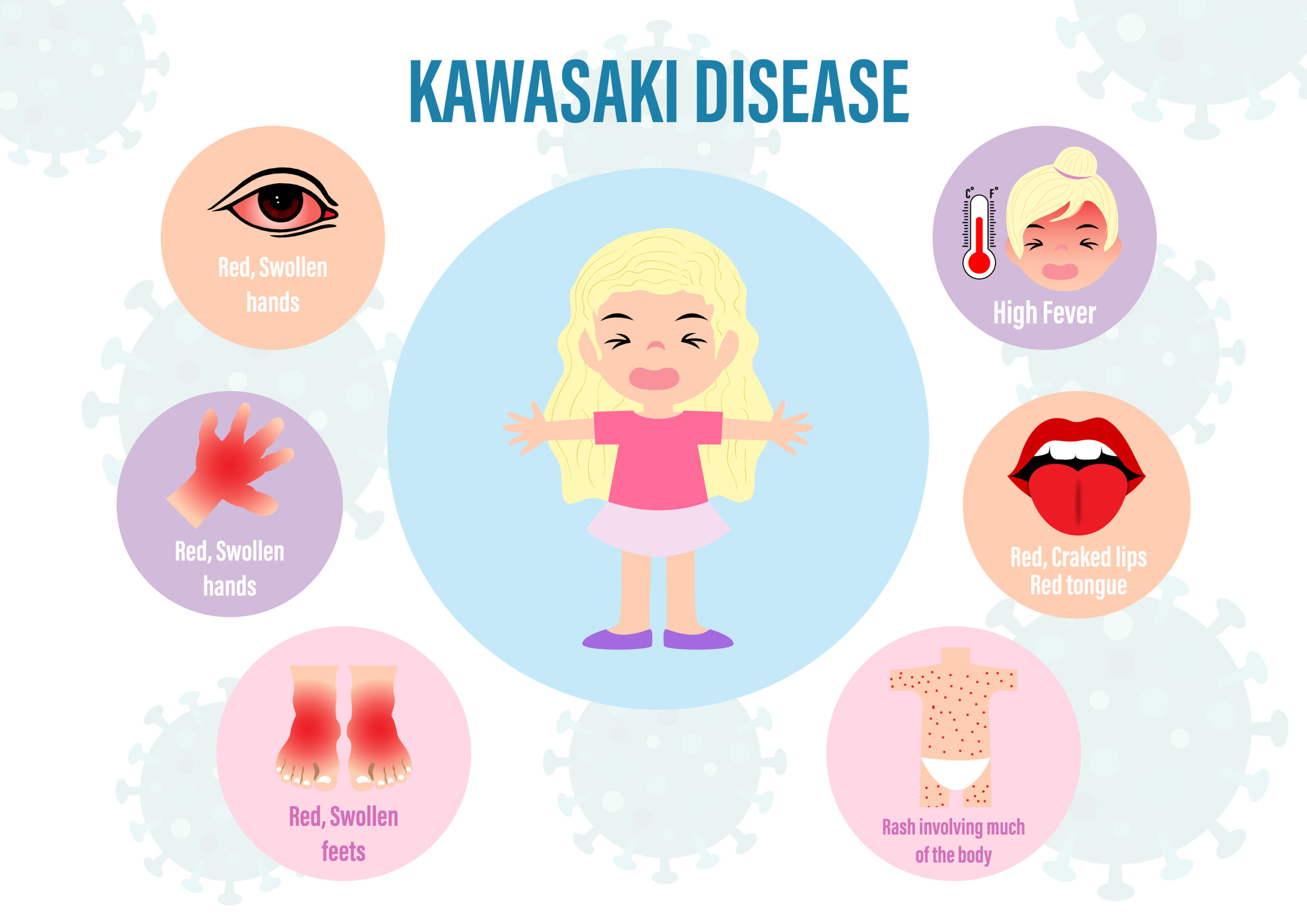 Kawasaki Disease: What Is, Symptoms, Diagnosis, and Treatment