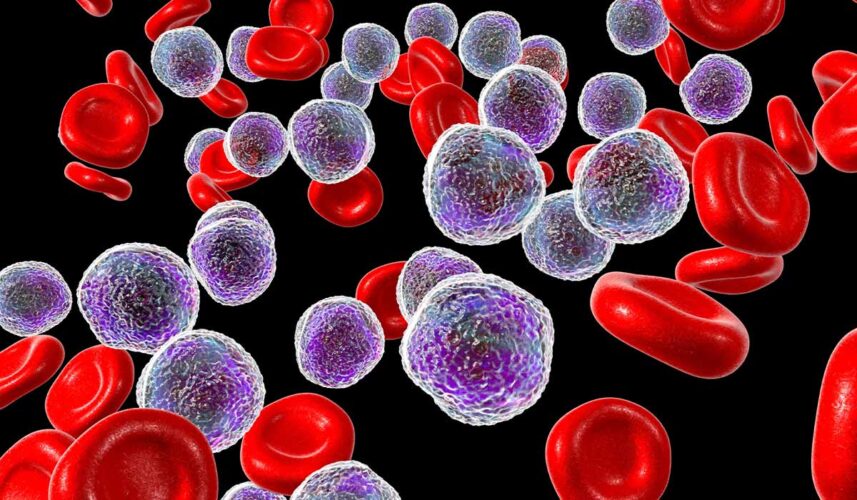 Leukemia: What Is, Causes, Symptoms, Treatment, and Diagnosis