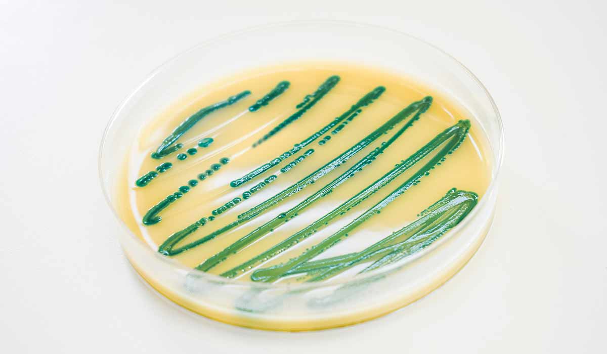 Listeria: What Is, Causes, Diagnosis, Symptoms, and Treatment