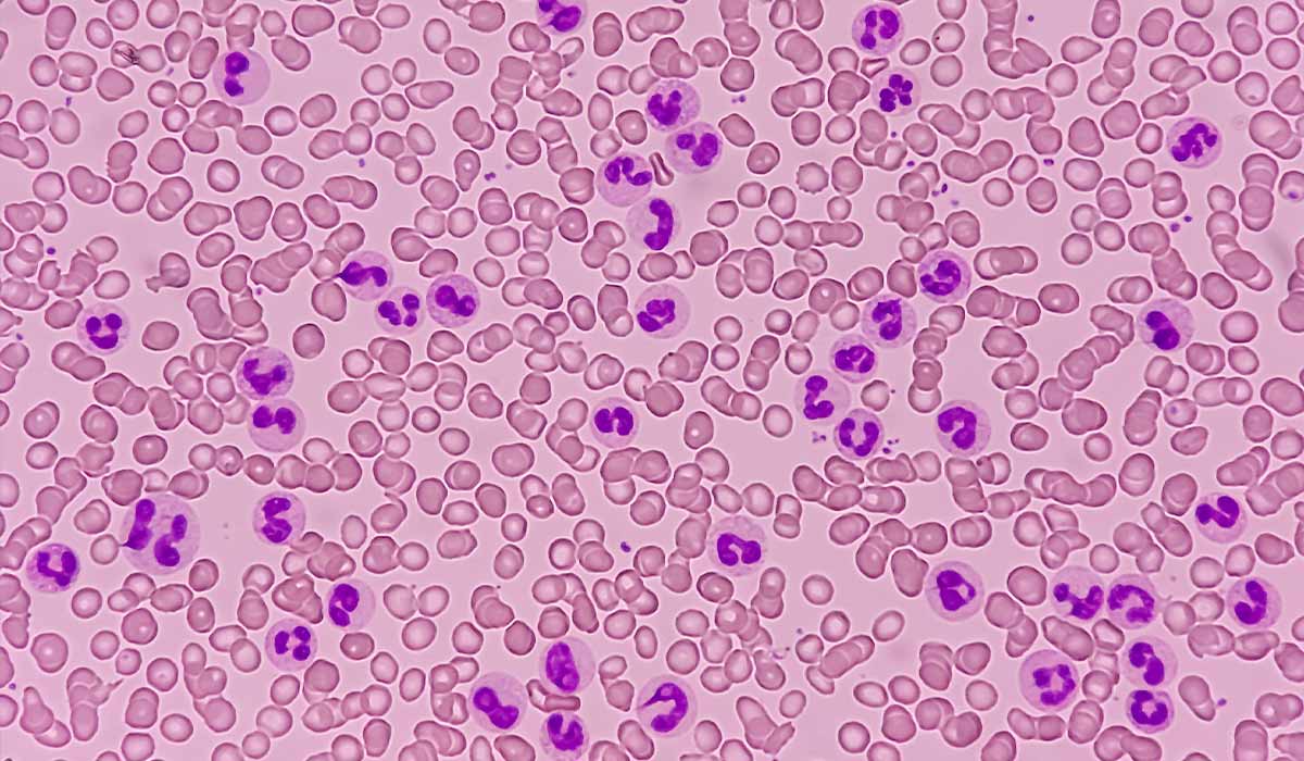 Neutrophils: What Is, Roles, Levels, Testing, and Treatment