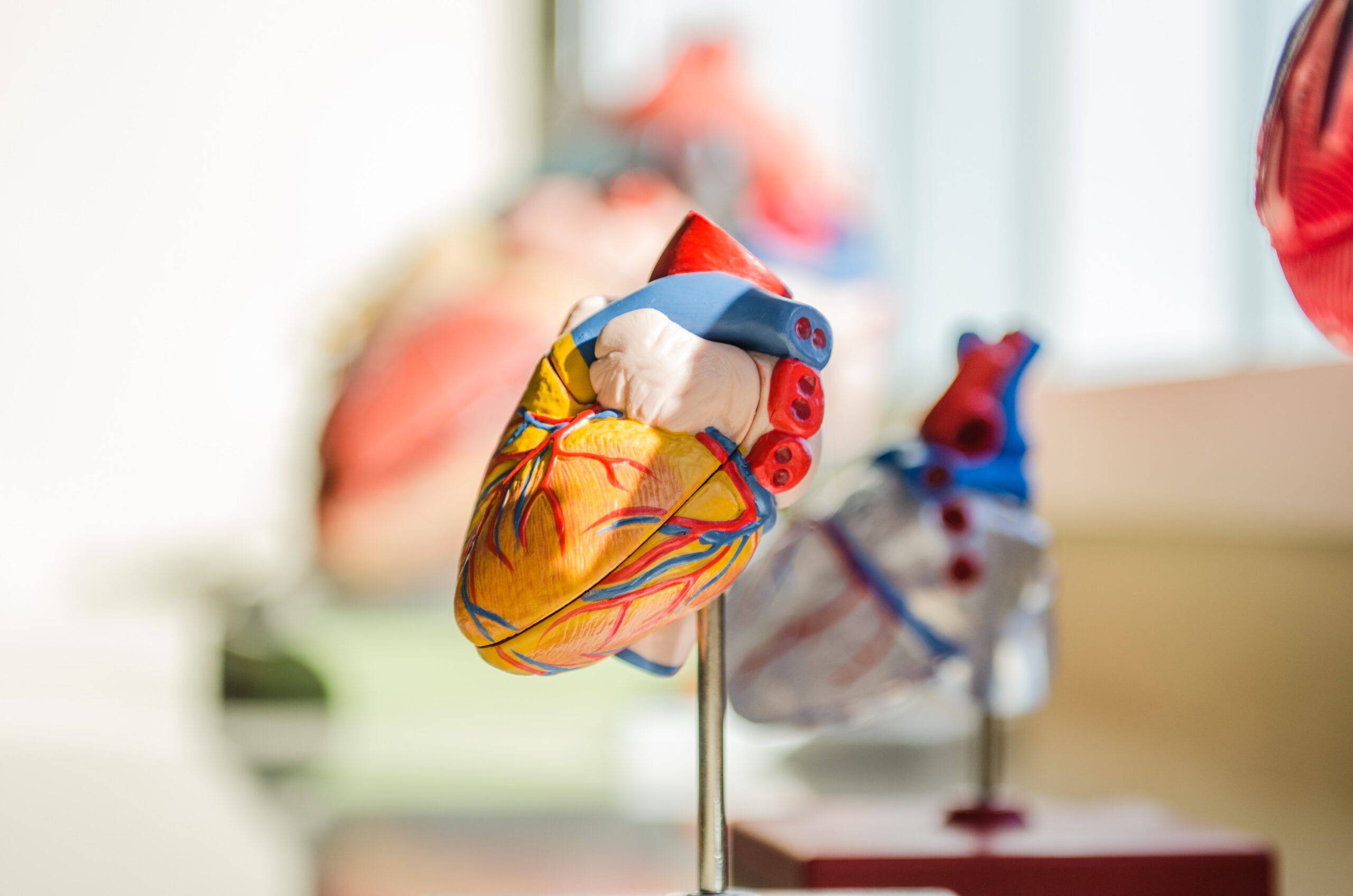 Atrial Fibrillation (AFib): What Is, Causes, Triggers, and Treatment