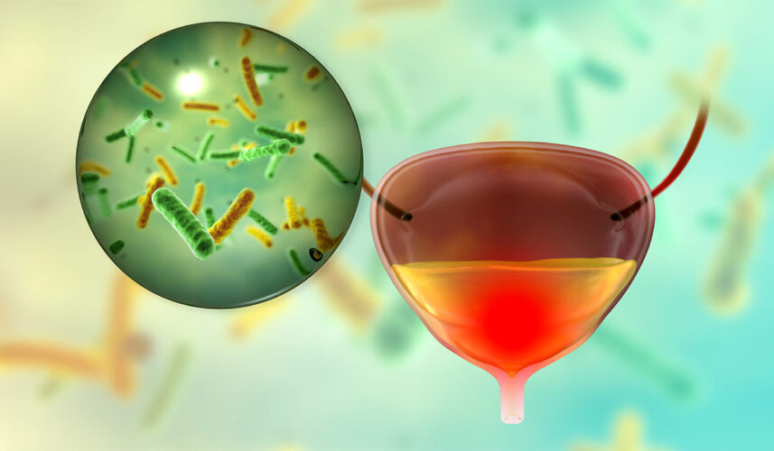 Cystitis: What Is, Types, Risk Factors, Diagnosis, and Treatment