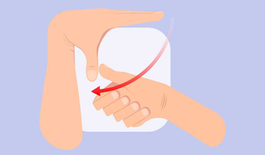 Ehlers-Danlos Syndrome: Symptoms, Causes, and Treatment