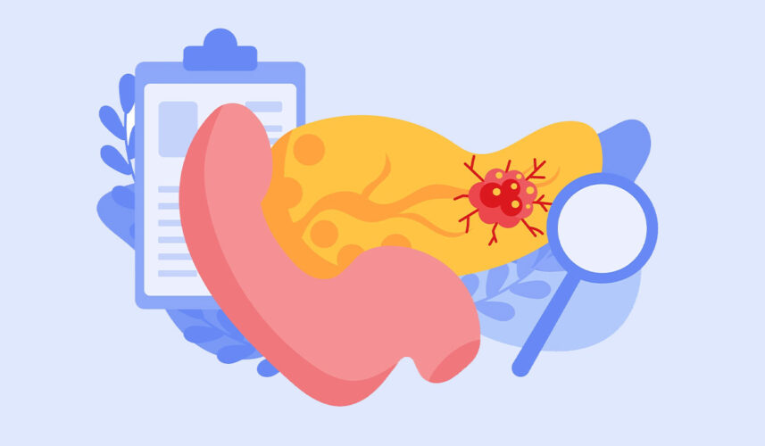 Pancreatitis: What Is, Symptoms, Causes, Diagnosis and Treatment