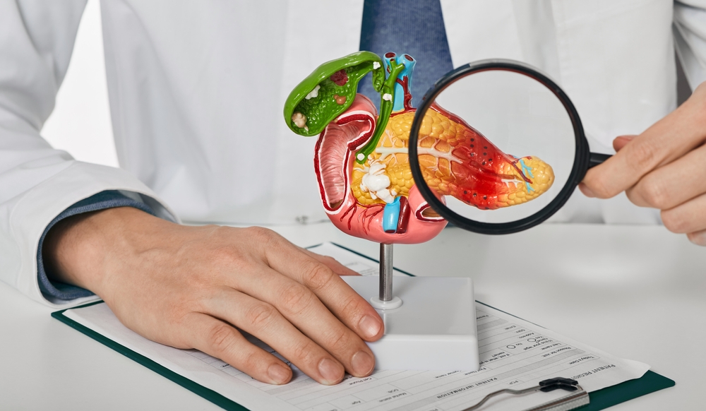 Pancreatitis: What Is, Symptoms, Causes, Diagnosis and Treatment