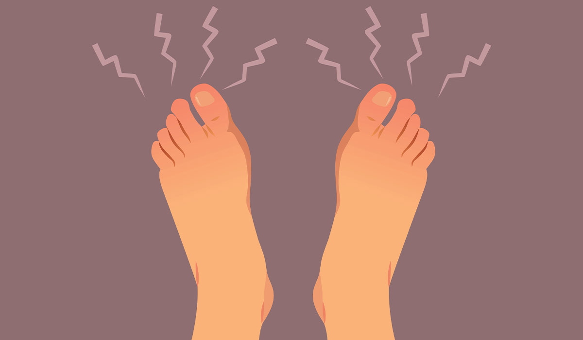 Athlete's Foot: What Is, Types, Symptoms, Treatment, and Prevention