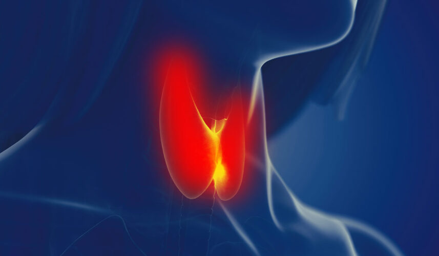 Goiter: What Is, Types, Characteristic Symptoms, and Diagnostics