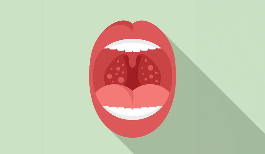 Herpangina: What Is, Causes, Risk Factors, Symptoms and Diagnosis