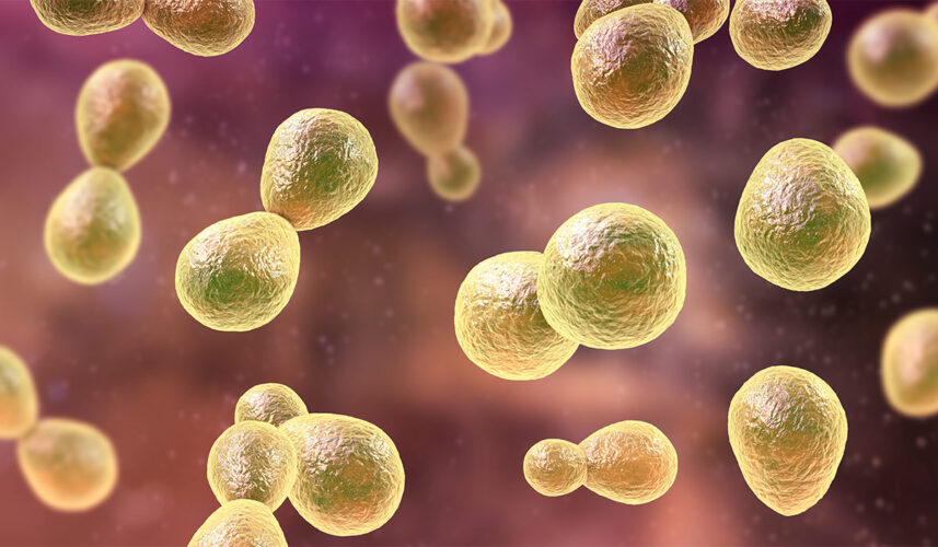 Histoplasmosis: What Is, Causes, Symptoms, Diagnosis, and Treatment