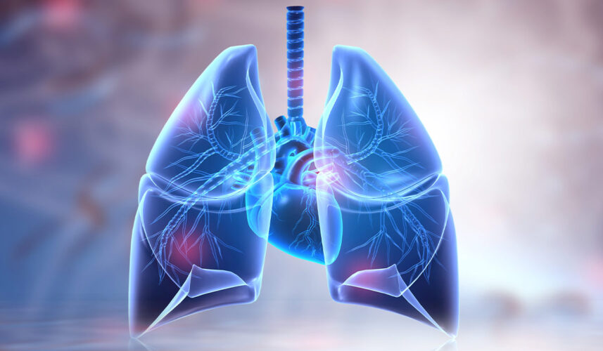 Hypercapnia: What Is, Risks, Causes, Levels, and Symptoms