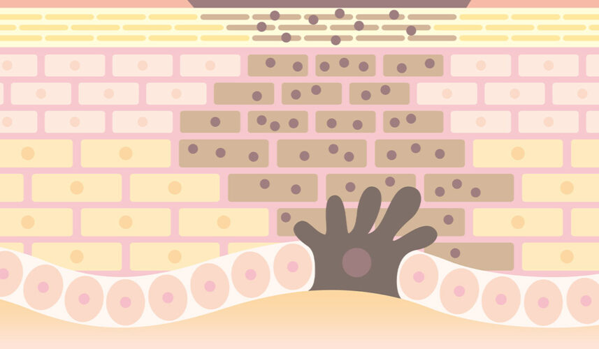 Melanin: What Is, Production, Functions, and Treatment