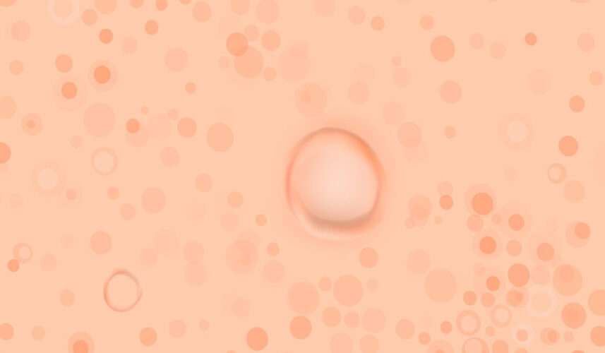 Pityriasis Rosea: What Is, Causes, Symptoms, Types and Diagnosis