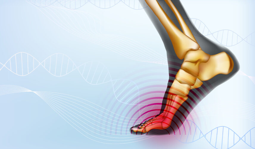 Turf Toe: What Is, Grades, Causes, Symptoms, and Treatment