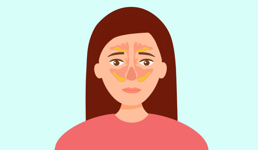 Deviated Septum: What Is, Causes, Symptoms, And Diagnosis