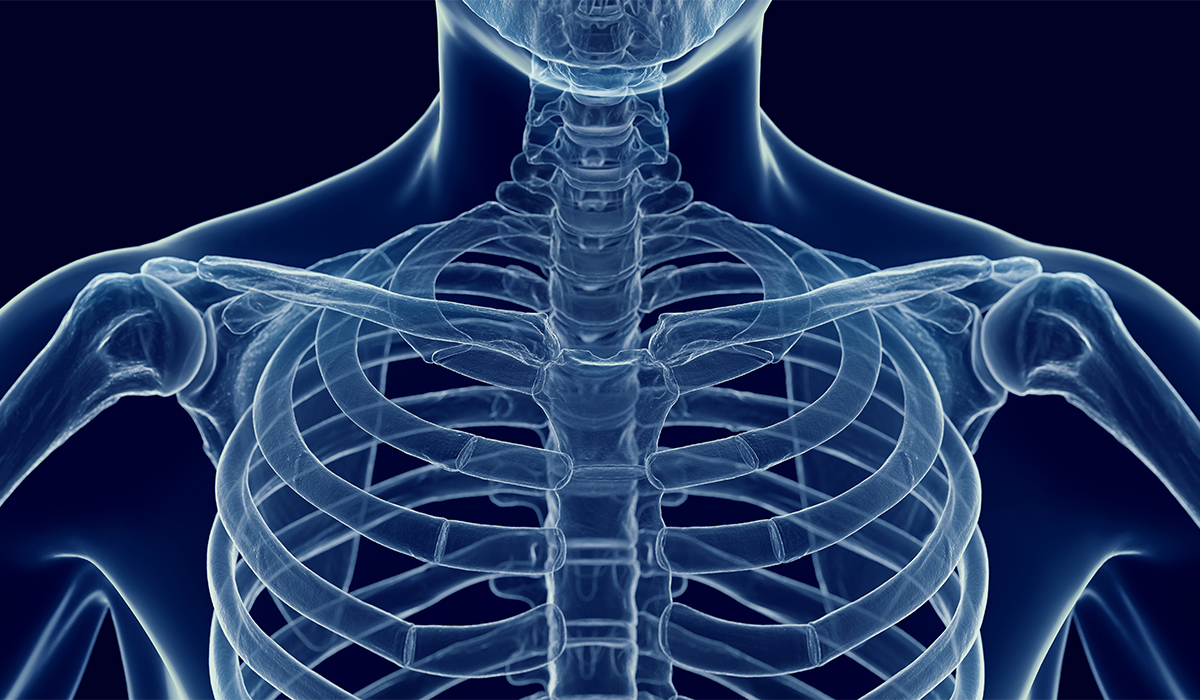 Costochondritis: What Is, Causes, Complications, Symptoms, and Treatment