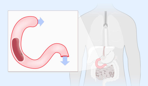 Duodenum: What Is, Anatomy, Functions, Diseases, and Medical Examinations