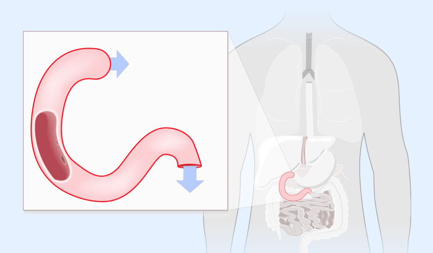 Duodenum: What Is, Anatomy, Functions, Diseases, and Medical Examinations