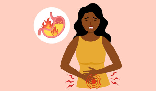 Indigestion: What Is, Causes, Symptoms, and Diagnosis