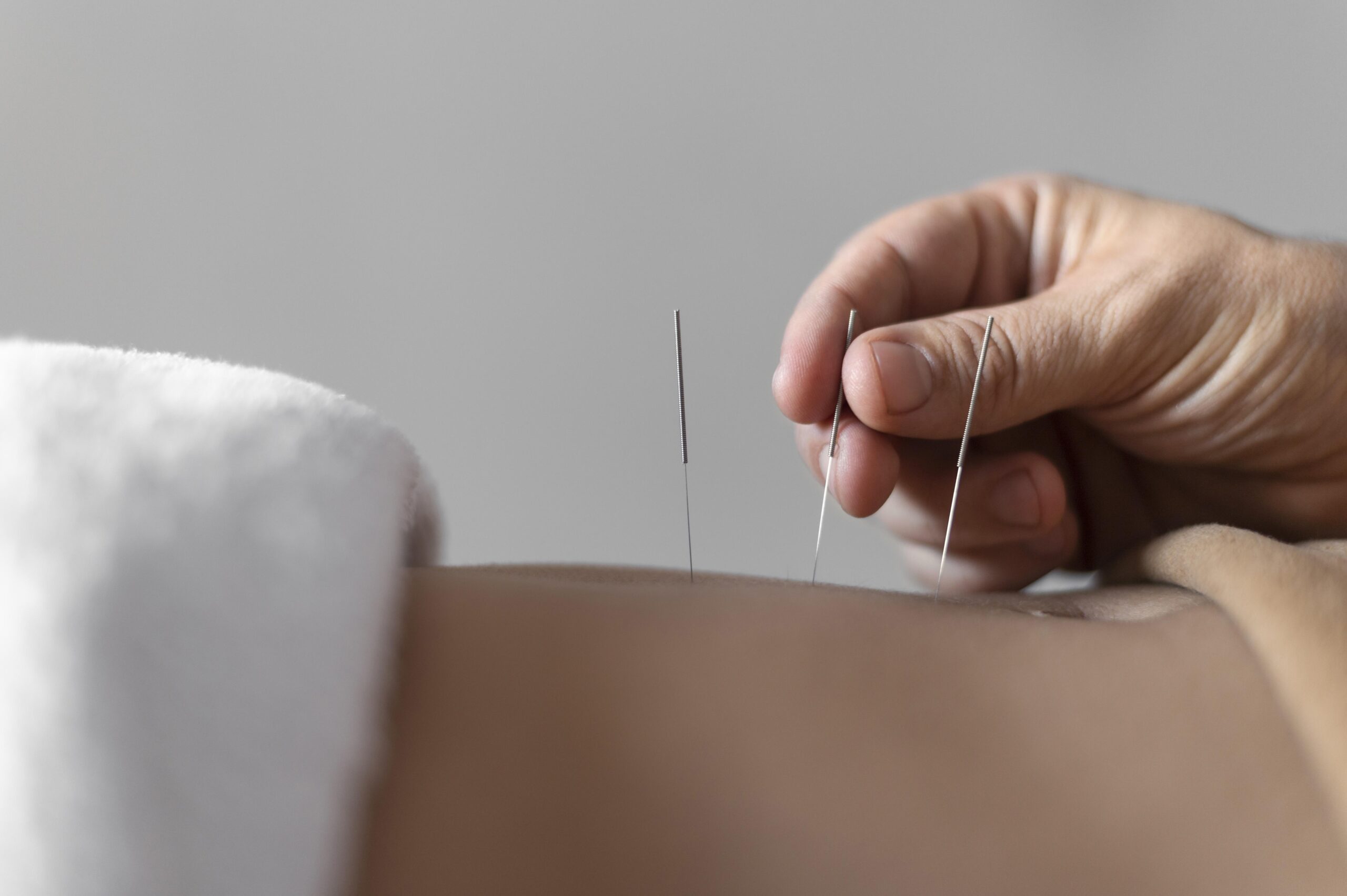 Acupuncture: What Is, Mechanism of Action, and Risks