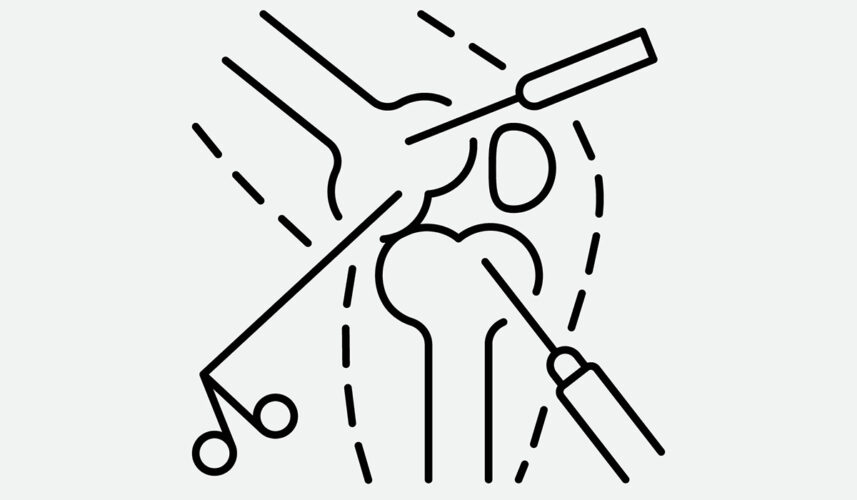 Arthroscopy: What Is, Types, Indications, and Contradictions
