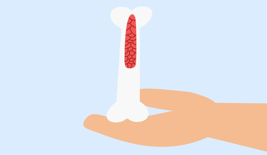 Bone Marrow: What Is, Anatomy, Functions, and Diseases