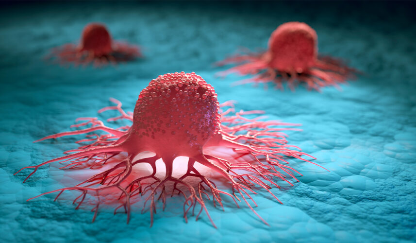 Cancer: What Is, Causes, Types, Symptoms, Diagnosis, and Treatment