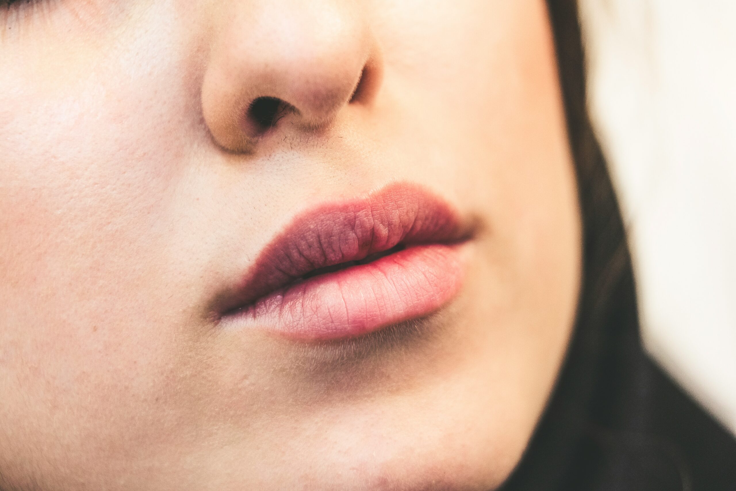Chapped Lips: What Are, Causes, and Medical Treatment
